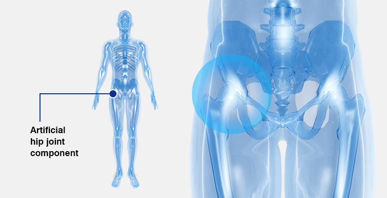 Medical equipment industry