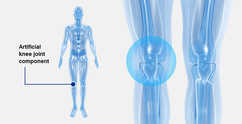 Medical equipment industry