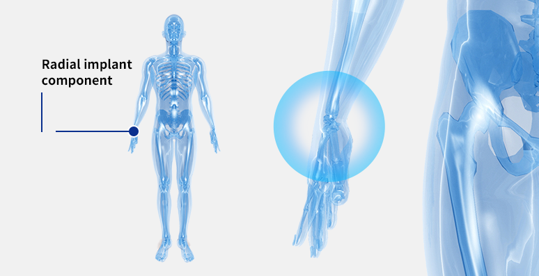Medical equipment industry